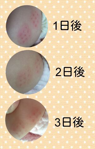 bcg 翌日 赤い 運転手 ニュース