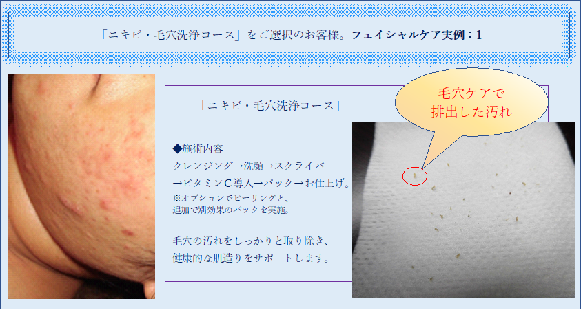 フェイシャルケア実例!! フェイシャルケア実例!!