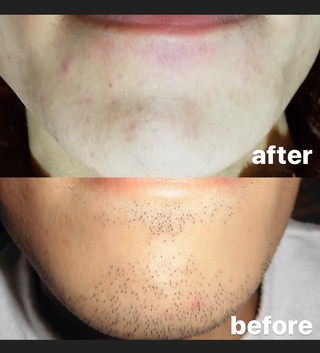 (^^)/ Before→After (^^)/ Before→After