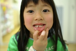 いよいよ大人の仲間入り?(歯のおうち)。