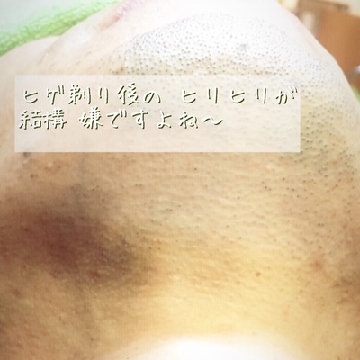 保湿してね! 保湿してね!