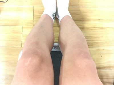 毛は 深いところにある 毛は 深いところにある
