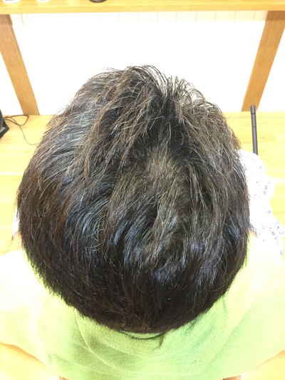 IKUMOU 育毛 IKUMOU 育毛