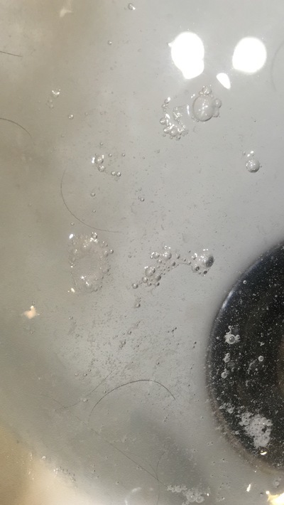 頭皮の汚れを取り除け! 頭皮の汚れを取り除け!