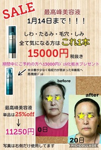 格安❗️美容液❗️美容液年に一度の大特価❗️ 2017/12/20 00:15:25