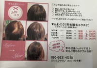 育毛&増毛  ふわエク   うるま市初！？ 2018/03/28 13:41:47
