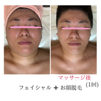 小顔フェイシャル アフター 2024/11/06 18:36:46