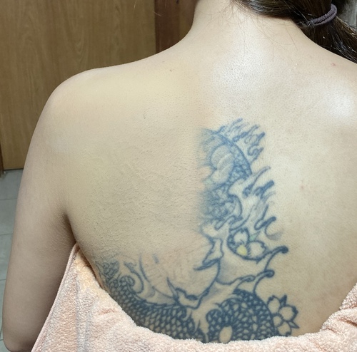 沖縄　TATTOO隠し　