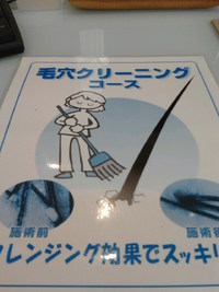 頭皮も年末の大掃除　・・・　♪ 2015/12/19 19:28:48