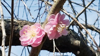 盲腸ガン（大腸がん）　手術から　退院まで