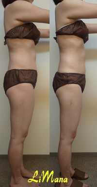 Body結果写真【お試し⑥】 2015/06/17 17:42:16