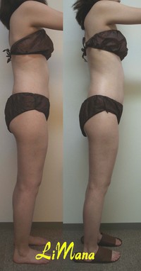 Body結果写真【お試し⑨】