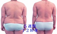 痩身【月間モニター】始めます♪