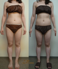 Body結果写真（モニター⑬12回目） 2014/12/19 17:36:16