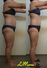 Body結果写真【モニター⑯12回目】 2015/02/18 13:26:07