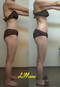 Body結果写真【モニター⑱9回目】 2015/04/06 18:30:07
