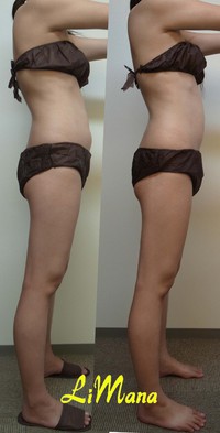 Body結果写真【モニター㉓3回目】