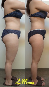 Body結果写真【モニター㉒6回目】 2015/07/16 15:12:14