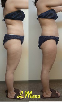 Body結果写真【モニター㉔6回目】