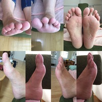 9月29日は足裏分析体験会 in HitodeHouse