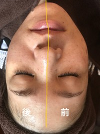 毛穴ケアモニター様募集 2018/05/22 00:47:52