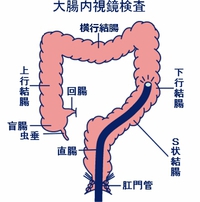 大腸検査行って来ました 2015/06/10 16:45:35