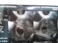 My womb's heart… 2014/03/06 17:02:14
