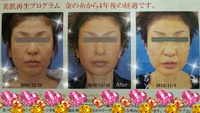 航空チケット・１泊宿泊費   無料 2014/01/08 19:14:00