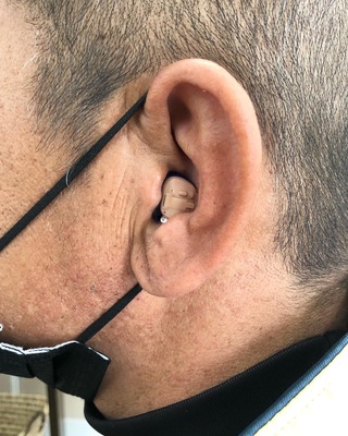 クロス補聴システム- 耳あな型