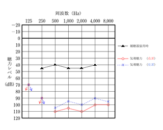 相談→診断→申請→審査→交付