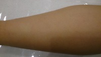 光脱毛 2014/02/13 16:28:35
