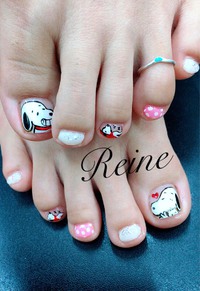 FOOTNAIL 2017/07/29 11:43:53