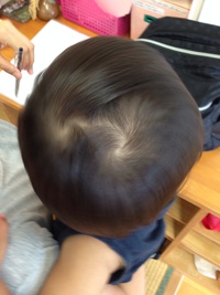 アレルギーかと思いきや、、、。 2015/09/01 23:28:34