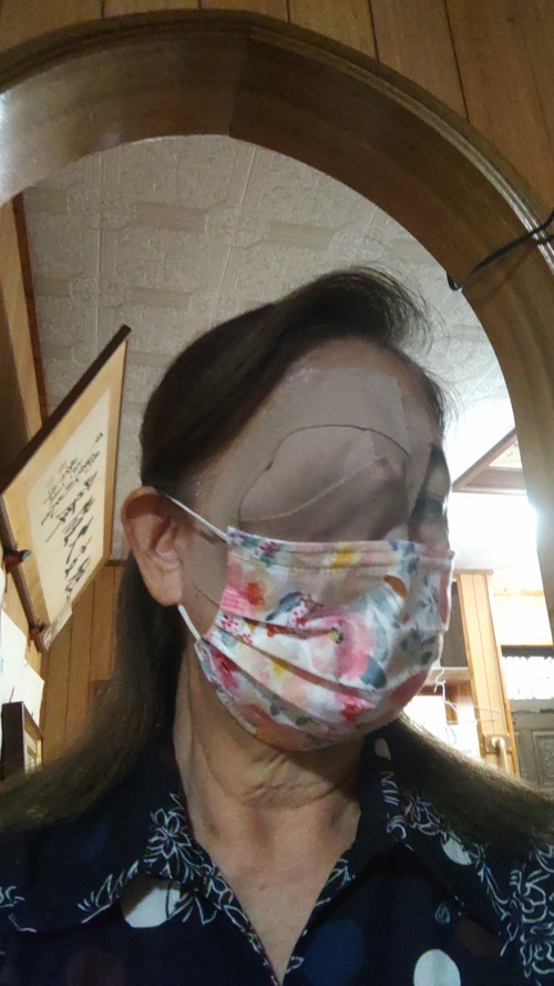 右目白内障手術後　今朝はこんな感じ　ホラー!?　＆カニステル