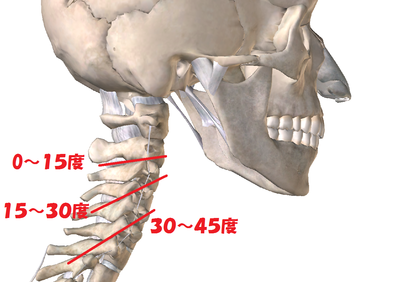 頚椎症やストレートネックへの「牽引治療」