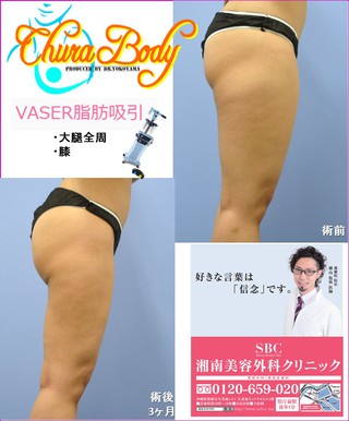 スッキリしっかりダイエット＝横山医師でしょ！