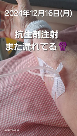 254位[もう血管が可哀想]