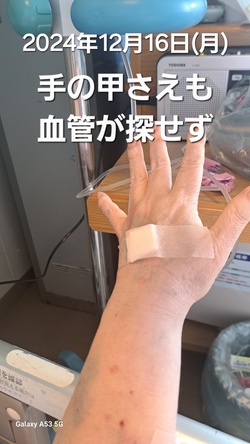 254位[もう血管が可哀想]