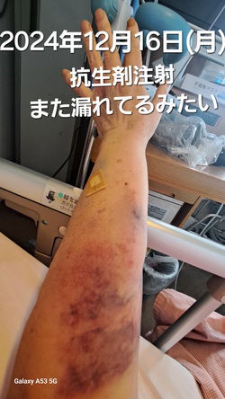 254位[もう血管が可哀想]