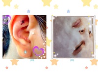 CO2炭酸パック♡耳つぼジュエリー*\(^o^)/*