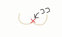おしりに注射 2016/02/27 18:54:56