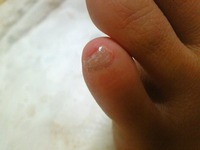 爪が。。。 2010/12/11 23:56:17