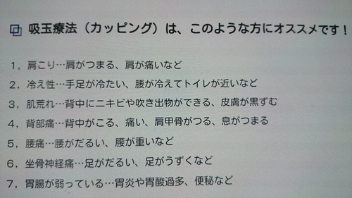 カッピング